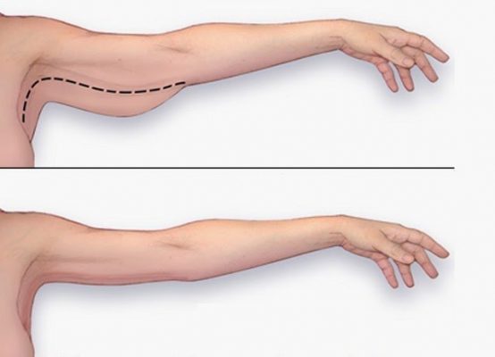 Công thức làm kem tan mỡ