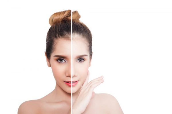 Ủ trắng kích trắng tắm trắng Lacosme